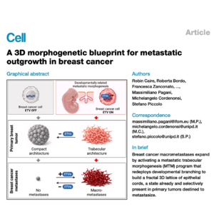 825-3D Morphogenetic Blueprint of Breast Cancer Metastasis