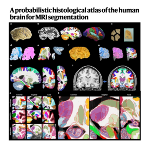 258-NextBrain:概率性人脑组织学图谱