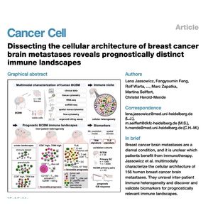 1001-乳腺癌脑转移的免疫景观与预后生物标志物