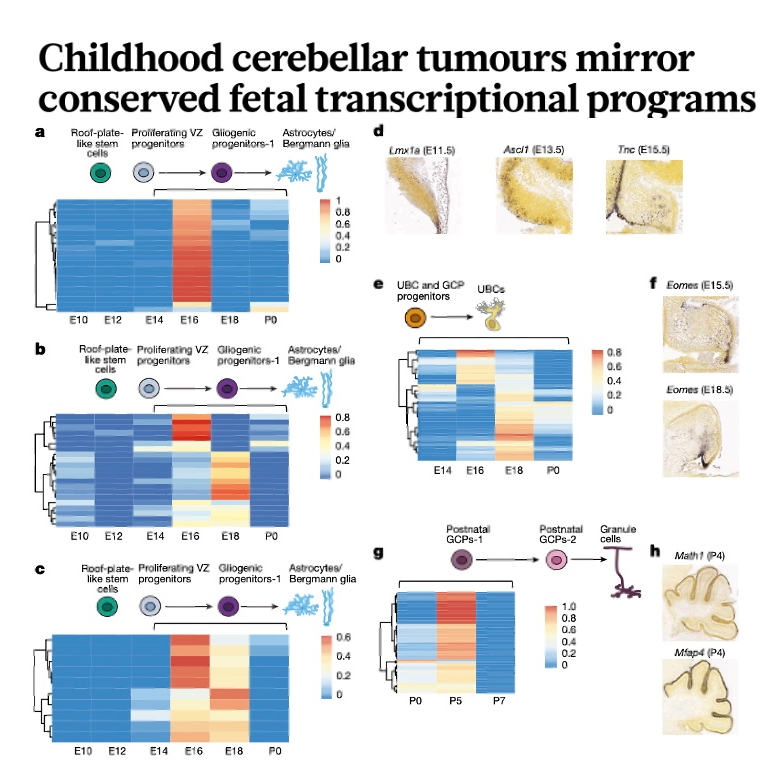 644-Cerebellar Tumour Origins in Fetal Programs episode artwork
