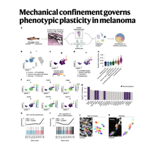 109-Mechanical confinement governs plasticity in melanoma