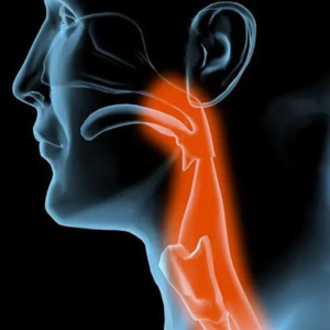 VOL.48耳鼻咽喉科｜卡鱼刺的误区｜咽炎｜火锅+冰饮=急性会厌炎=10分钟丧命？别慌，来听医生怎么讲