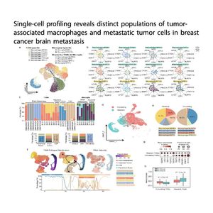 1444-Breast Cancer Brain Metastasis progression