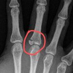 横行跋扈的漫游癖