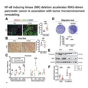 1446-NIK Deletion Accelerates Pancreatic Cancer Progression
