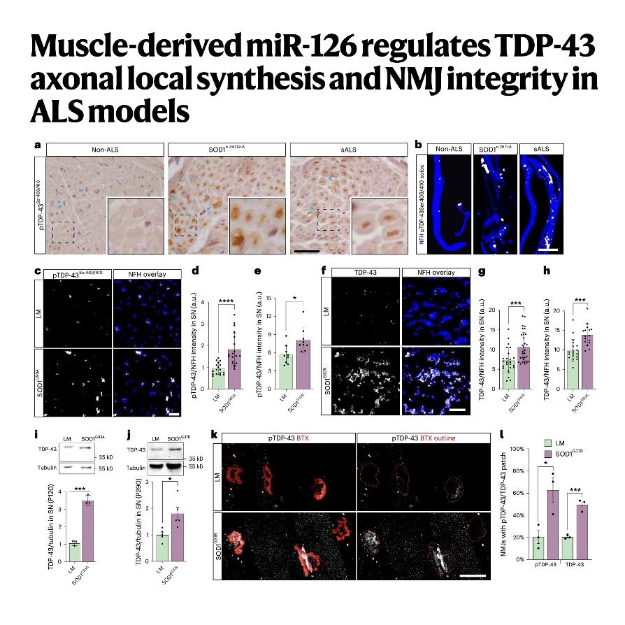 935-Muscle EVs and miR-126 Regulate TDP-43 and NMJ Integrity episode artwork