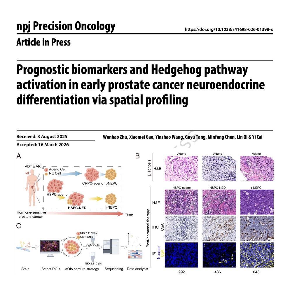 1264-Prostate Cancer Neuroendocrine Differentiation episode artwork