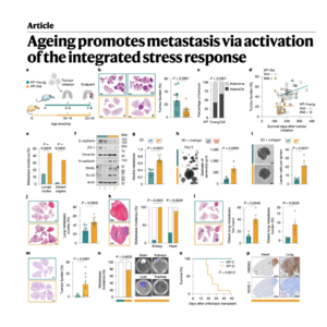 745-衰老诱导的ATF4激活促进肺癌转移