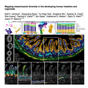 160-Spatial Atlas of Developing Human Intestinal Fibroblasts