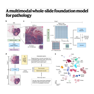 303-TITAN: Multimodal Whole-Slide Pathology Foundation Model