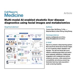 1652-3D-FAICE: Facial AI for Steatotic Liver Diagnostics