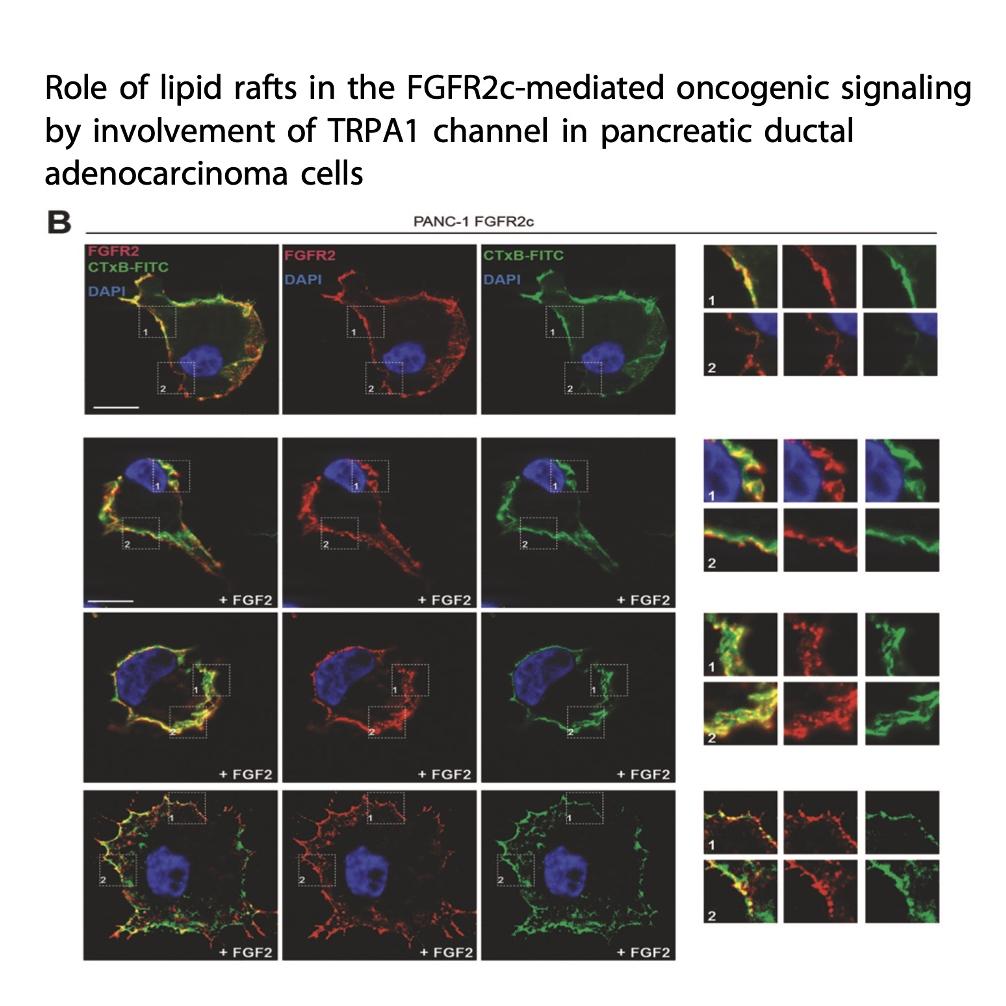 1434-Lipid Rafts and TRPA1 in Pancreatic Cancer episode artwork
