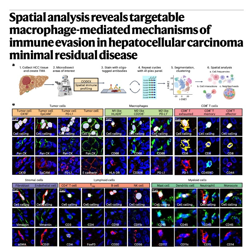 668-Spatial Stem-Like Evasion in Residual Liver Cancer episode artwork