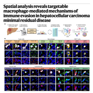 668-空间组学揭示肝癌微小残留病灶的免疫逃逸机制