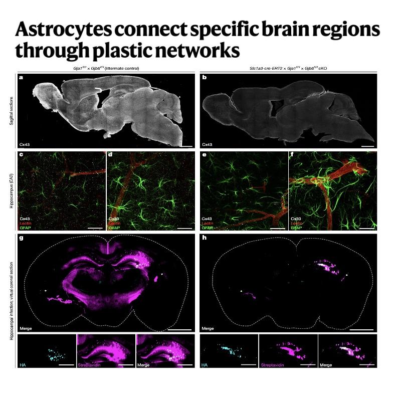 969-Plastic Architecture of Brain-Wide Astrocyte Networks episode artwork