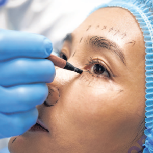 迈阿密的丰臀，贝弗利山庄的丰胸手术