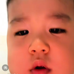 毛囊炎我恨你洗头梳我爱你