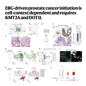 228-ERG-Driven Prostate Cancer Requires KMT2A and DOT1L