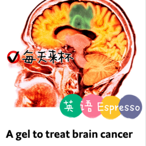 【45】科学家发现脑癌治疗新策略