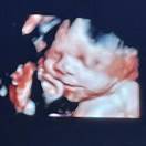 Nova是小小赛车手