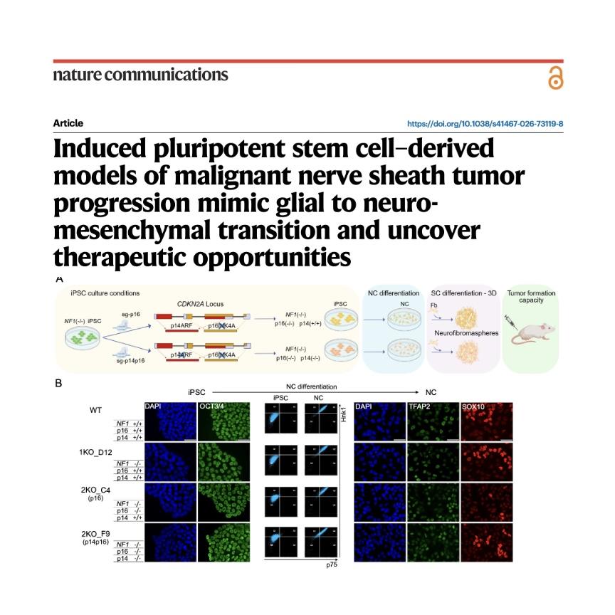 1283-Glial to Neuromesenchymal Transition in MPNST episode artwork