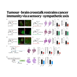559-Tumour–Brain Crosstalk Restrains Cancer Immunity
