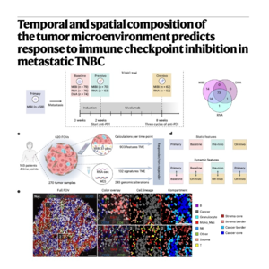 663-三阴性乳腺癌微环境时空演变与免疫治疗响应预测