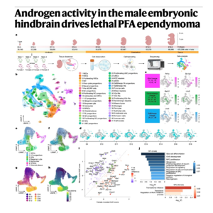 812-Androgen Activity and Male Bias in PFA Ependymoma