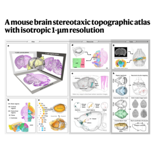 070-High-Resolution Mouse Brain Atlas
