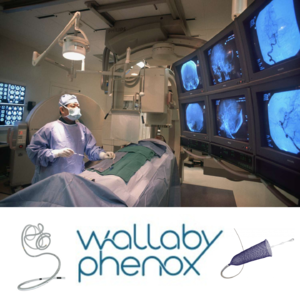 Episode16:Wallaby Phenox Group, An Expert of Neurovascular