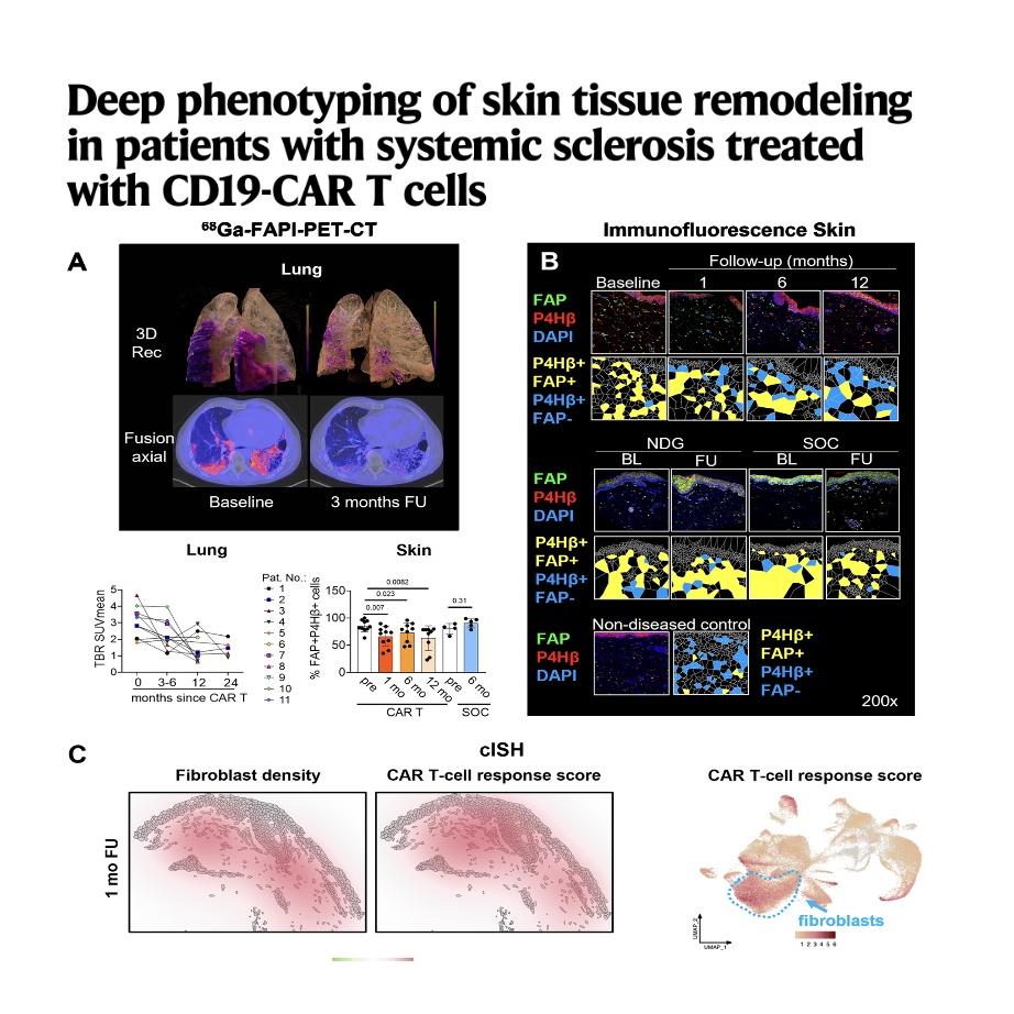1119-Regenerative Skin Remodeling in Systemic Sclerosis episode artwork