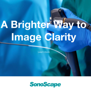 Episode13:Sonoscape, A Hidden Dragon of Medical Imaging