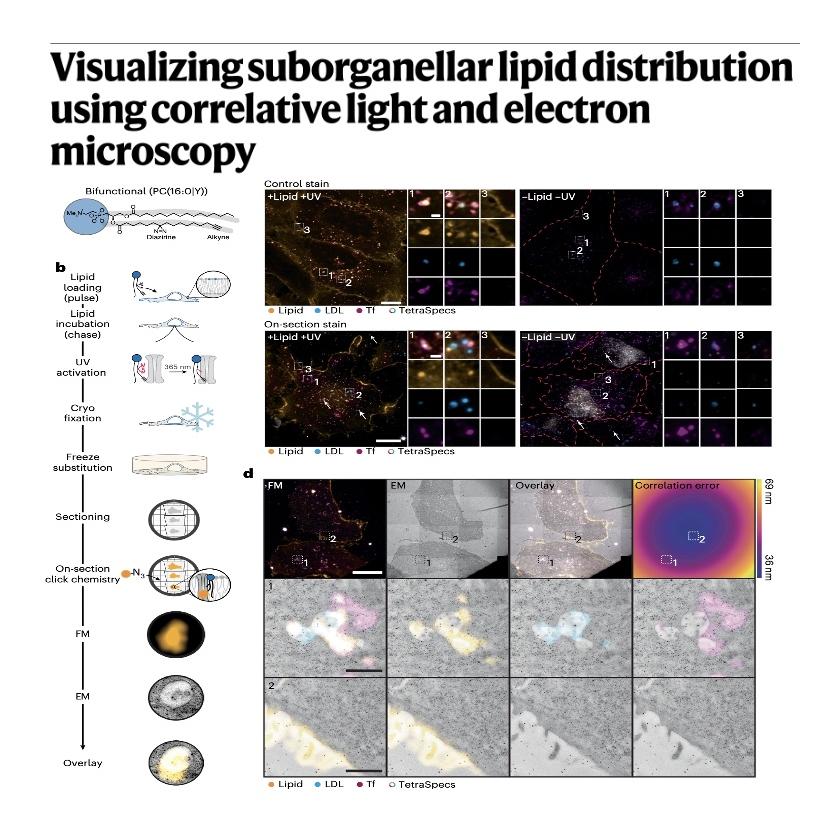 983-Lipid-CLEM: Visualizing Nanoscale Lipid Distribution episode artwork
