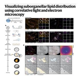 983-Lipid-CLEM: Visualizing Nanoscale Lipid Distribution