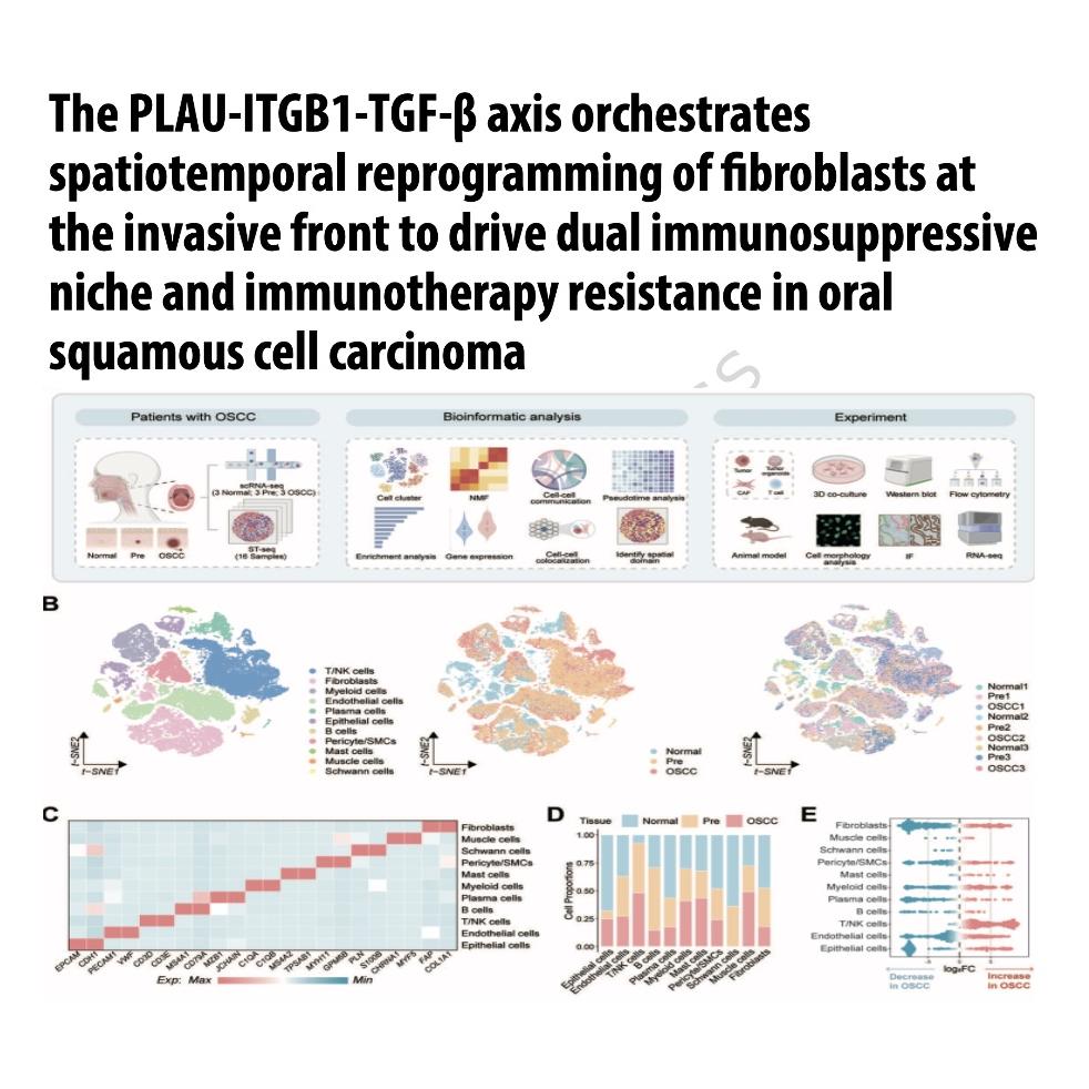 1406-The PLAU-ITGB1-TGF-β Axis in OSCC Immunosuppression episode artwork