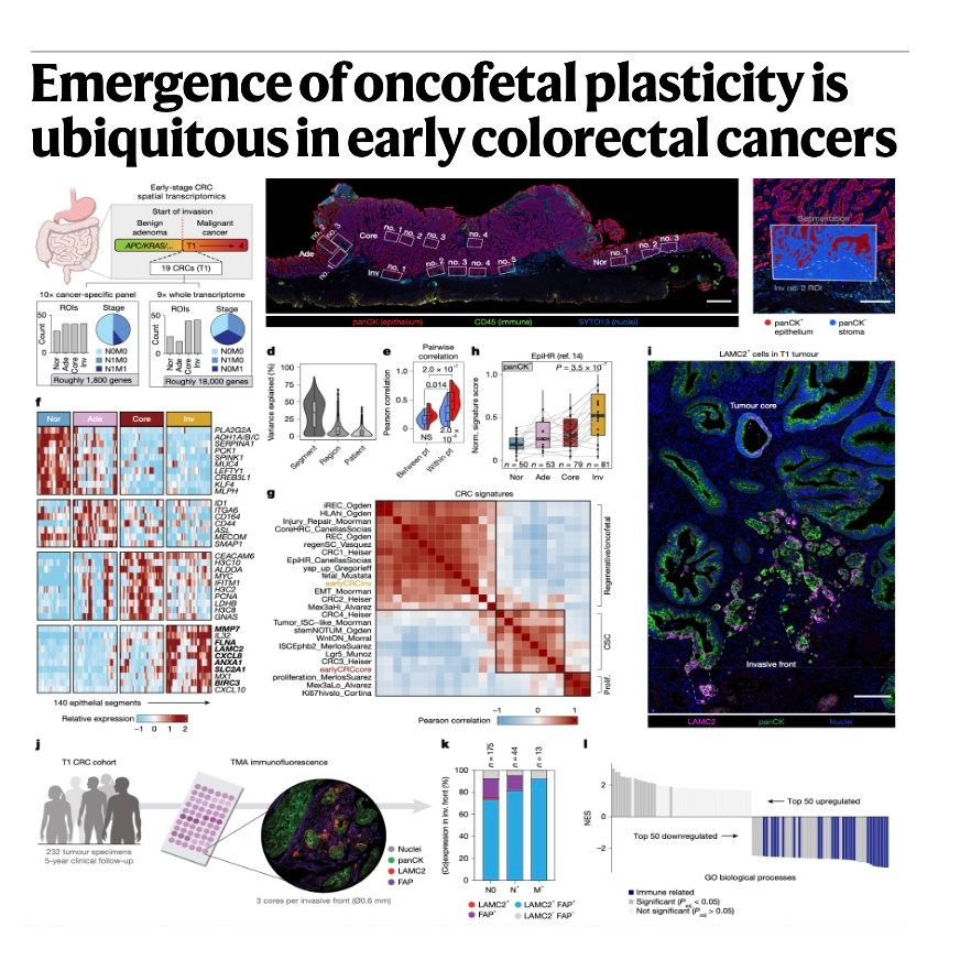 883-Oncofetal Plasticity in Early Colorectal Cancer episode artwork