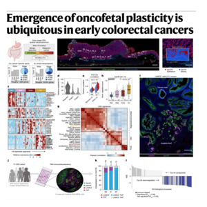 883-Oncofetal Plasticity in Early Colorectal Cancer