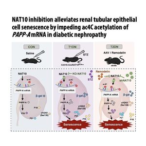 1458-NAT10-Mediated ac4C Acetylation Drives Renal Senescence
