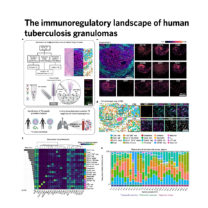566-The Landscape of HumanTuberculosis Granulomas