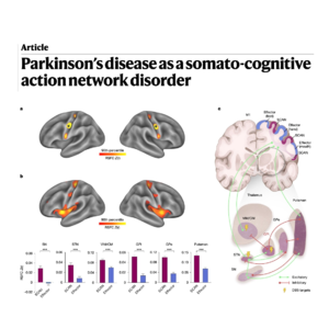 560-Parkinson’s disease as a somato-cognitive disorder