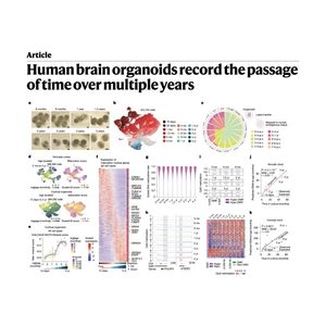 1538-Maturation of Long-Term Human Brain Organoids