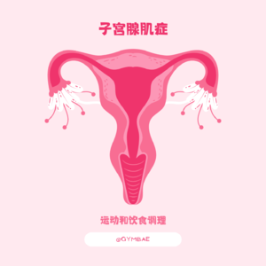 Ep.48 | 子宫腺肌症患者的运动和饮食