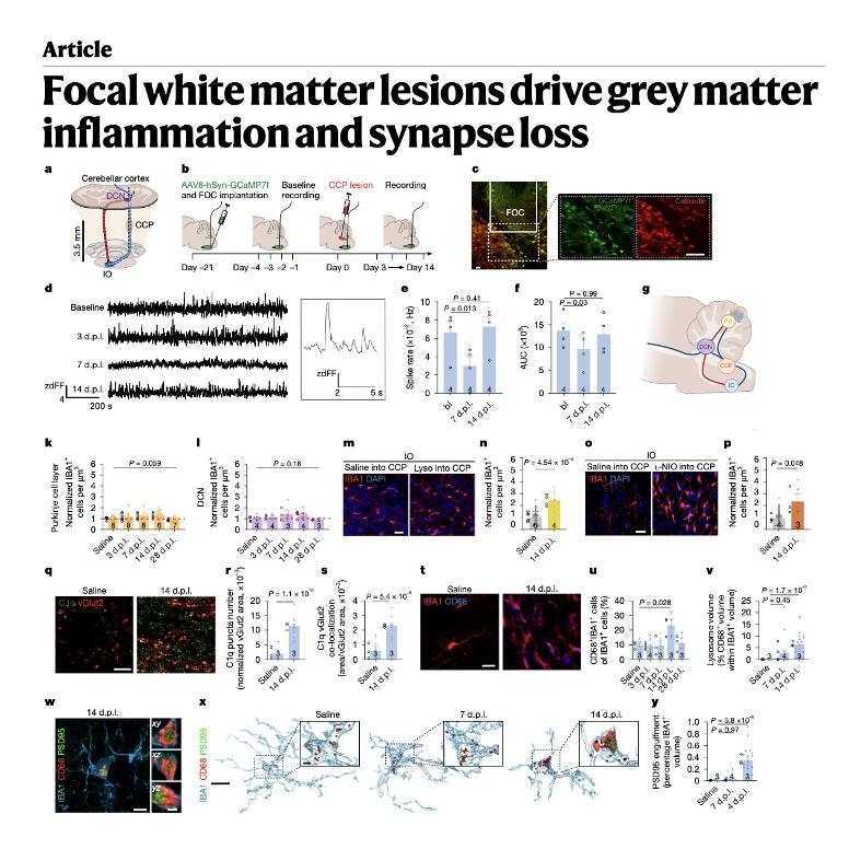 968-White Matter Lesions Drive Grey Matter Inflammation episode artwork