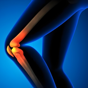 E104:髂胫束疼，跑者避不开的痛?