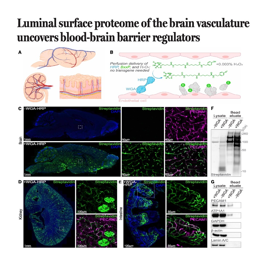 888-Proteome of Brain Vasculature across the Lifespan episode artwork