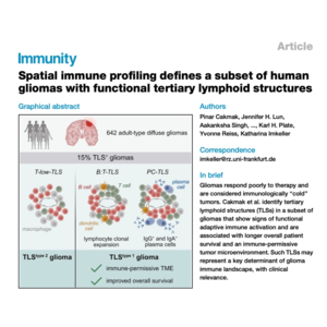 240-TLS Determine Glioma Immune Microenvironment
