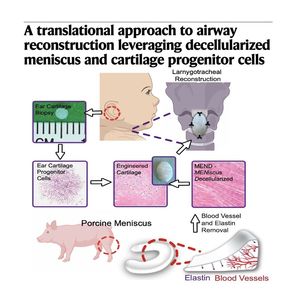 1286-Meniscus Scaffolds for Pediatric Airway Reconstruction