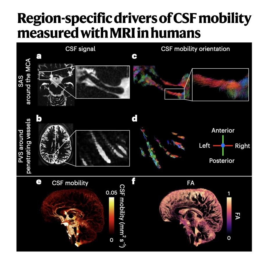 937-Region-Specific Drivers of Human CSF Mobility episode artwork
