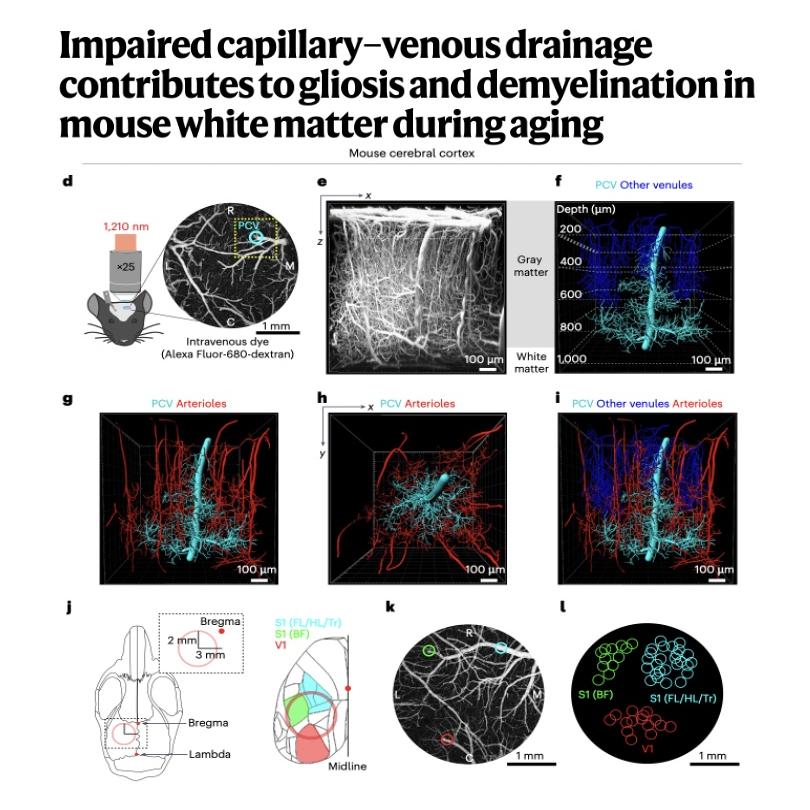 933-Deep Drainage and White Matter Decline in Aging Brain episode artwork