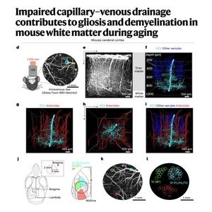 933-Deep Drainage and White Matter Decline in Aging Brain